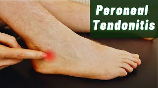 Peroneal Tendonitis Explained by Foot Specialists [upl. by Simeon637]