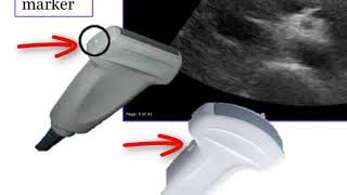 Introduction to Radiology Ultrasound [upl. by Ynnavoeg]