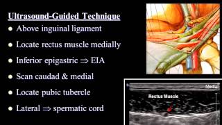 Pain Medicine  Ilioinguinal Nerve Iliohypogastric Nerve Inguinal Canal TAP [upl. by Thecla586]