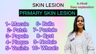 primary skin lesions lecture in Hindi with easy explanation [upl. by Hadeehsar]