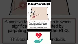 Mcburney sign appendicitis Top Health Exam Questions Loksewa Entrance MBBSMDMS and PSC in Nepal [upl. by Napas]