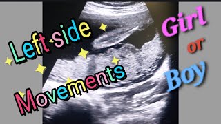 Posterior Placenta With Fetal Heartbeat 130bpm  Left side Baby Movement  27Weeks Baby Genderreveal [upl. by Stephenson]