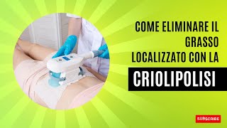 Come eliminare il grasso localizzato con la criolipolisi [upl. by Crowns]