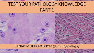 Test Your Pathology Knowledge Part 1 [upl. by Adiana]