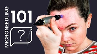 How to MICRONEEDLE 101 Answering Microneedling Pen Questions [upl. by Neyuh]