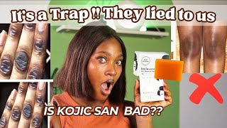 WHY KOJIC SAN SOAP IS NOT WORKING FOR YOU  HOW TO SPOT THE FAKE  Do’s amp Don’t [upl. by Mauralia]