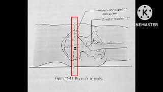 Bryants triangle  Hip joint special test [upl. by Alberta]