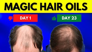 8 Magic Natural Oils for Massive Hair Growth  You Wont Believe It [upl. by Aible]