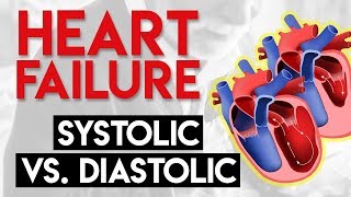 Systolic vs Diastolic Heart Failure  Heart Failure Part 2 [upl. by Kuebbing284]