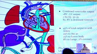 Approach to acyanotic heart disease by DrSK Dwivedi [upl. by Lucila]