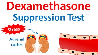 Dexamethasone suppression test DST  Cushings syndrome [upl. by Attoynek919]