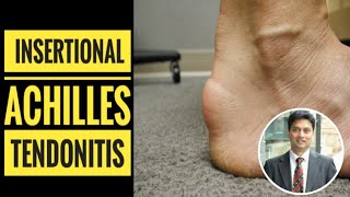 Insertional Achilles Tendinitis How to Diagnose [upl. by Moncear272]