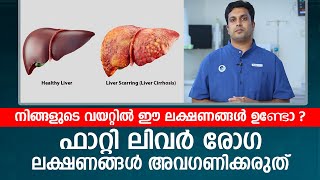 നിങ്ങളുടെ വയറ്റിൽ ഈ ലക്ഷണങ്ങൾ ഉണ്ടോ  Fatty Liver രോഗ ലക്ഷണങ്ങൾ അവഗണിക്കരുത് [upl. by Reeta]