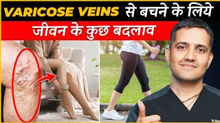 Treatment Of Varicose Veins Became Easy With Lifestyle Changes  Dr Gaurav Gangwani IR [upl. by Alyled776]