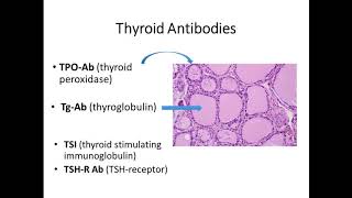 2016 Interpreting Abnormal Thyroid Function Tests amp Understanding Indications for Treatment [upl. by Pinkham]