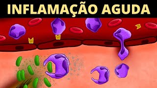 Inflamação Aguda  Imunologia Veterinária [upl. by Eatnod]