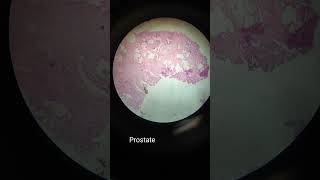 Histopathological slides under microscope [upl. by Krefetz943]