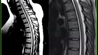 neuroradiology masterclass P1 [upl. by Conias]