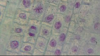 Onion Root Tip Mitosis  Mr Pauller [upl. by Elbam]