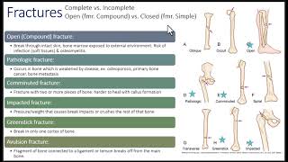 Musculoskeletal Disorders Part 1 [upl. by Abate]