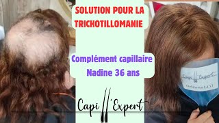 La solution idéale pour le manque de cheveux chez la femme  Complément Capillaire  explication [upl. by Carolle]