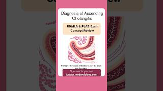 Diagnosis of Ascending Cholangitis  UKMLA Exam preparation  PLAB exam preparation  USMLE ukmla [upl. by Peria570]