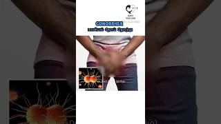 Gonorrhoeae பாலியல் நோய் தொற்று Dr Isacc Abbas [upl. by Akemed]