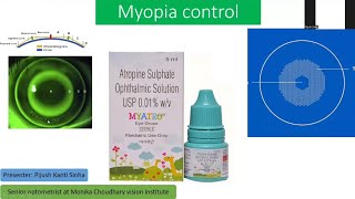 Myopia control methods part 1 Atropine therapy explained [upl. by Sass]