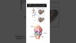 Lets learn how to perform quotMcMurray Test quot for meniscal injury of knee [upl. by Etteyniv]