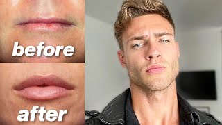 How To Get Bigger More Attractive Lips for guys [upl. by Mccallum903]