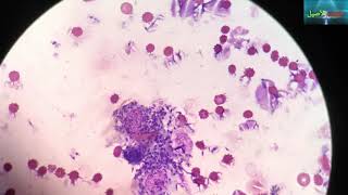 leishmania under the microscope  leishmaniose  الليشمانيا [upl. by Anisirhc277]