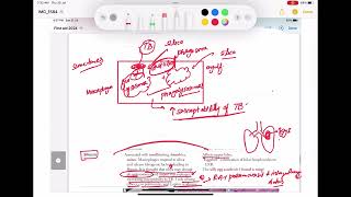 Pneumoconiosis Asbestosis Silicosis Berylliosis coal work Respiratory 42 First Aid USMLE Step1 [upl. by Anirec]