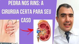 Cirurgia de pedra nos rins qual a melhor escolha para seu caso [upl. by Llaccm]