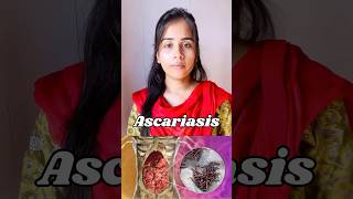 Ascariasis  protozoan disease🦠causes symptoms  transmission ascaris neet biology shortvideo [upl. by Yrocal]