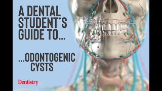 ODONTOGENIC CYST ODONT ACADEMY OF LEARNING 8497888181 [upl. by Jelena536]