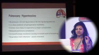 DAY 2  PRESENTATION 11 BY DR AMARJA NAGRE [upl. by Lilias]