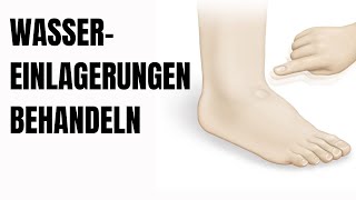 So behandelst du Wassereinlagerungen in den Beinen [upl. by Nihsfa]