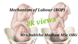 Mechanism of labourright occipito posterior by babitha mathew [upl. by Yvan]