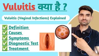 Vulvitis in Explain in Hindi  Causes Symptoms And Treatment of Vulvitis [upl. by Hgielac]