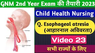 GNM 2nd Year Esophageal AtresiaVideo 23 Child Health Nursing आहारनाल अविवारताmedicalnursing [upl. by Yalonda]