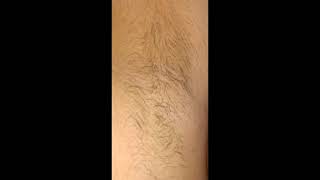 Armpit hair growth in 30 days timelapse [upl. by Cindee]