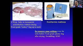 NRP in a nutshell  Neonatal Resuscitation Program [upl. by Eibot]