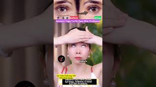 Ancient Yoga To Fix Eyes Skin Problems 😱 eyelift eyeexercise yoga beauty facialyoga shorts [upl. by Kokoruda308]