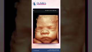 Expert Fetal Diagnosis And Growth Monitoring At Dr Aditis Fetal Medicine Centre Prayagraj [upl. by Greenwood]