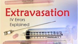 Extravasation  IV Infiltration Errors Explained Doctor Interview [upl. by Nerrag]