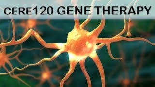 Gene Therapy Medical Animation CERE120 [upl. by Aihtibat]