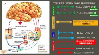 Challenges with Parkinsons disease [upl. by Refinney655]