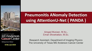 Technical Talk Predicting Immune Checkpoint Inhibitor Pneumonitis in Lung Cancer Patients Using [upl. by Enneyehs]