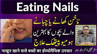 Eating Nails ناخن کھانا नाखून खाना and Its Homeopathic Treatment by Dr Waqar Bhutta in Urdu  Hindi [upl. by Anilesor]