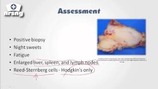 Lymphoma NCLEX® Review  NRSNGacademycom [upl. by Whittaker]